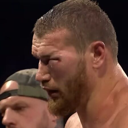 Арсланбек Махмудов показал ужасающие травмы лица после сенсационного нокаута от малоизвестного соперника