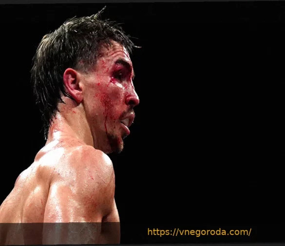 Майкл Конлан прощается с боксом после сенсационного поражения в родном Белфасте