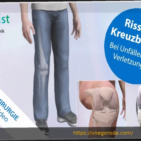 Разрыв крестообразной связки: Лука Марсейлер из Дармштадта выбыл на месяцы